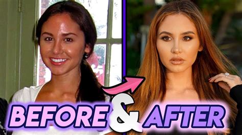 catherine paiz nose job|Catherine Paiz 